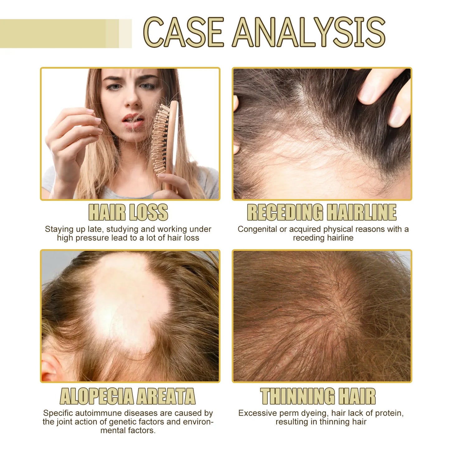 AureX™ Rosemary Hair Growth Oil