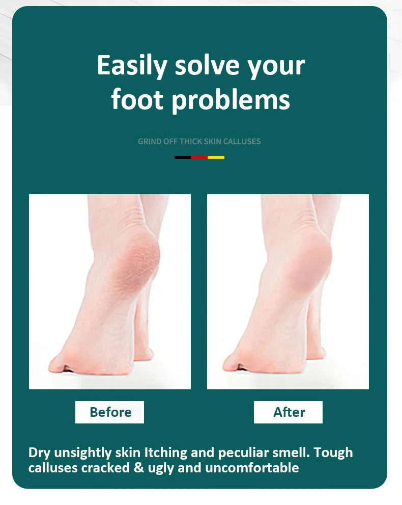 AureX™ Stainless Steel Foot File