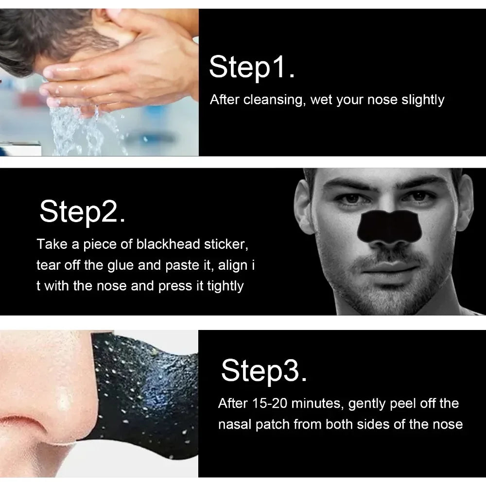 AureX™ Pore Cleanse Nose Strips