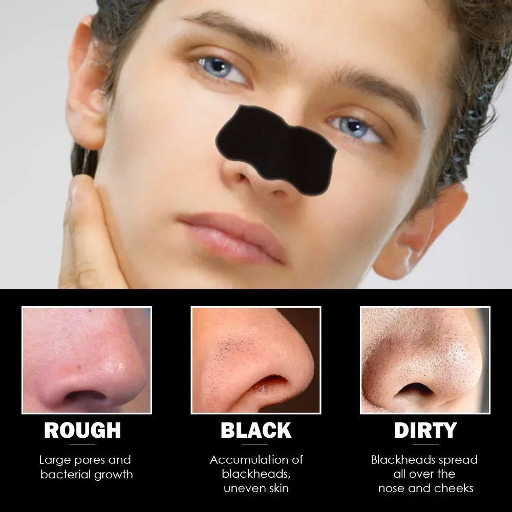 AureX™ Pore Cleanse Nose Strips