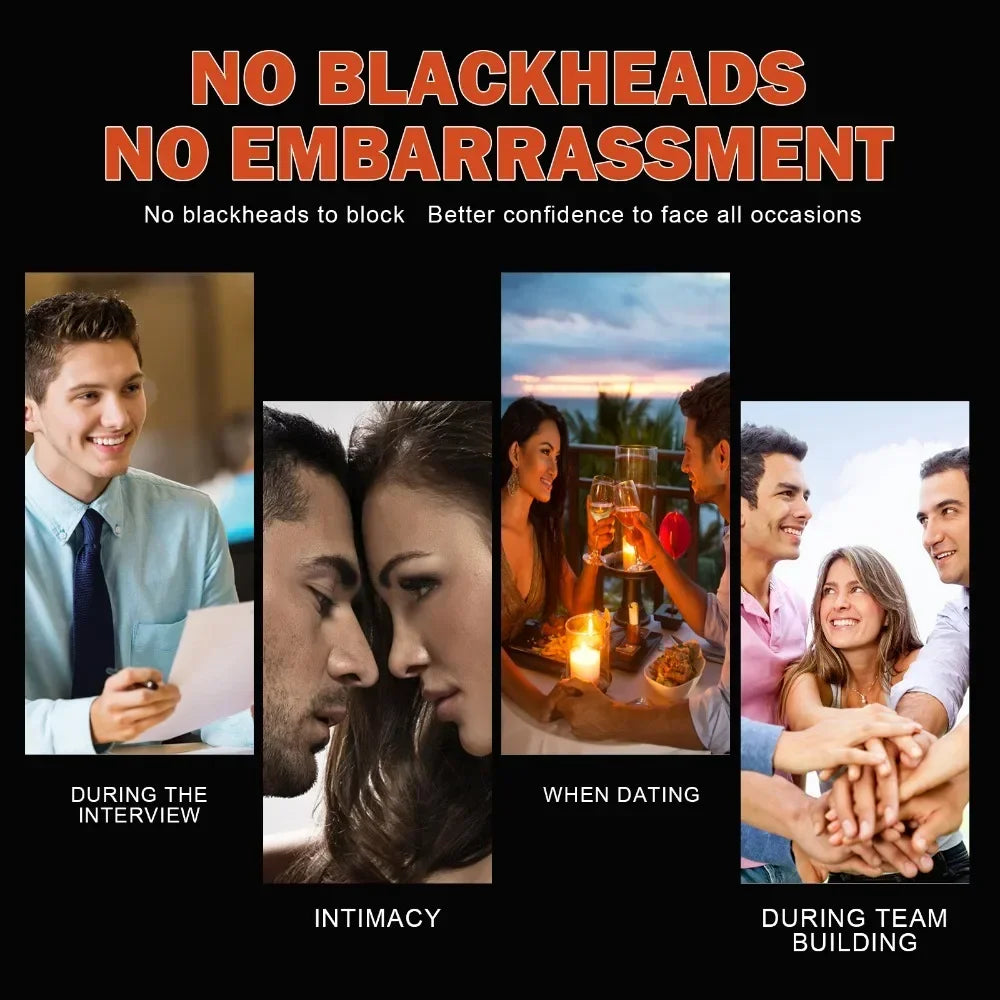 AureX™ Pore Cleanse Nose Strips