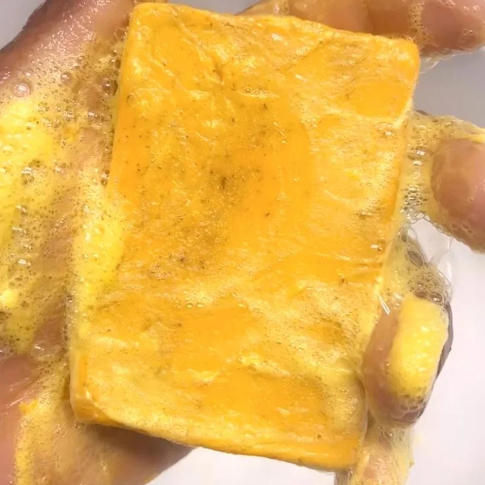 AureX™ Turmeric Glow Soap 100g